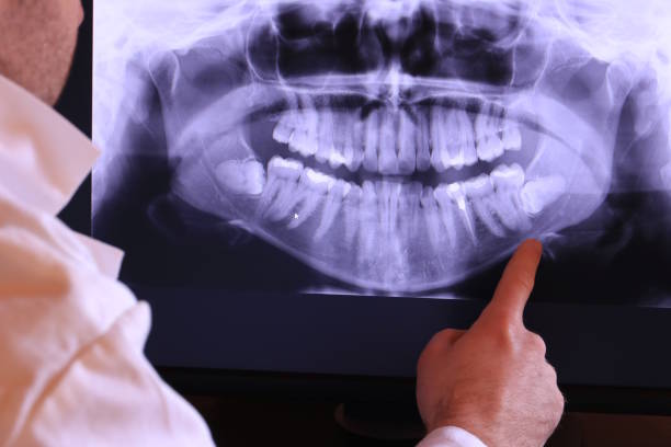 Best Broken or Chipped Tooth Repair in Ottawa, IL