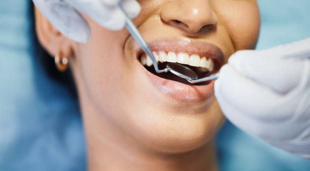 Best Broken or Chipped Tooth Repair in Ottawa, IL